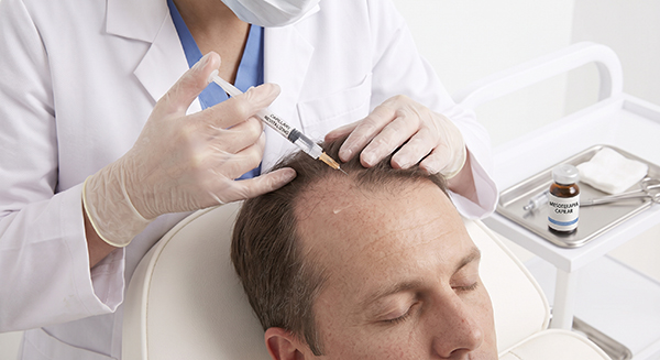 tratamiento perdida de cabello dermatologo guatemala